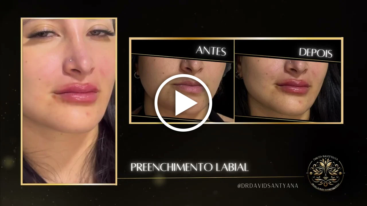 Vídeo Labial