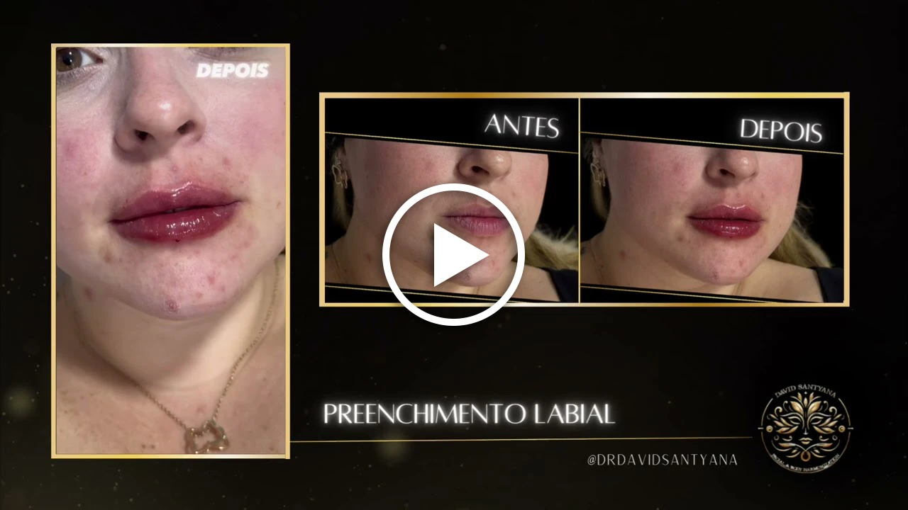 Vídeo Labial