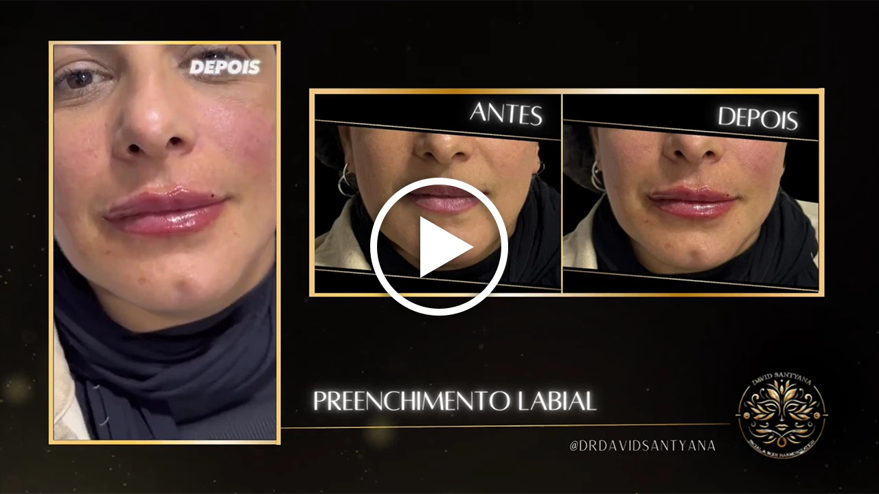 Vídeo Labial