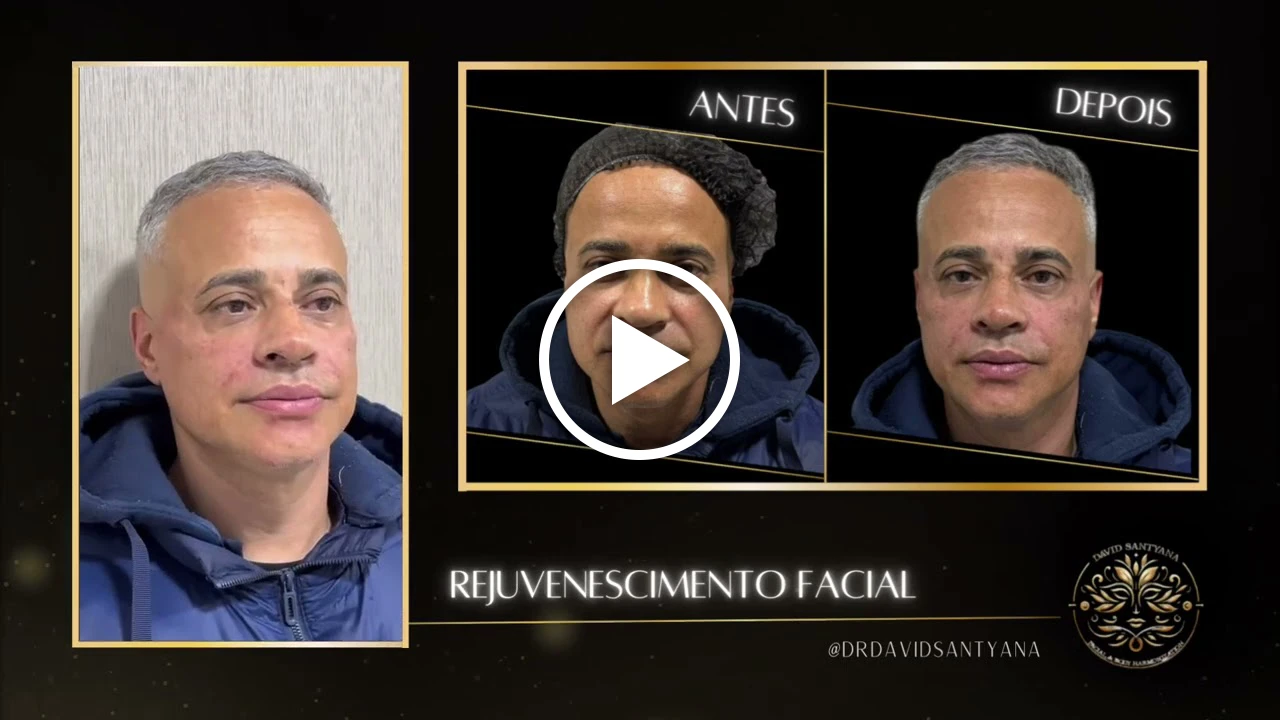 Vídeo Rejuvenescimento