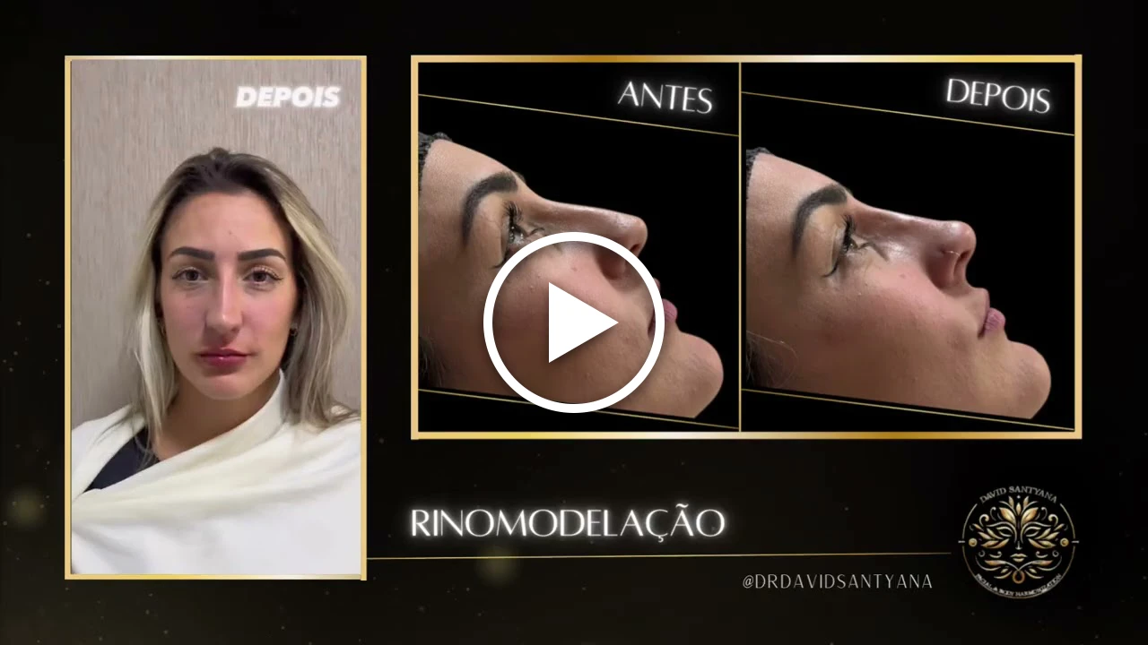 Vídeo Rinomodelação